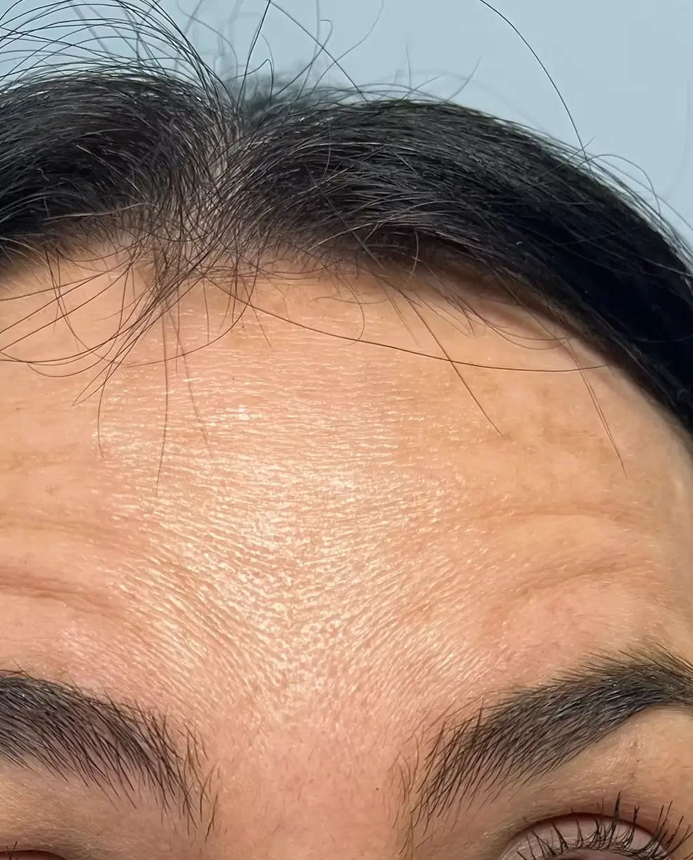 Before image