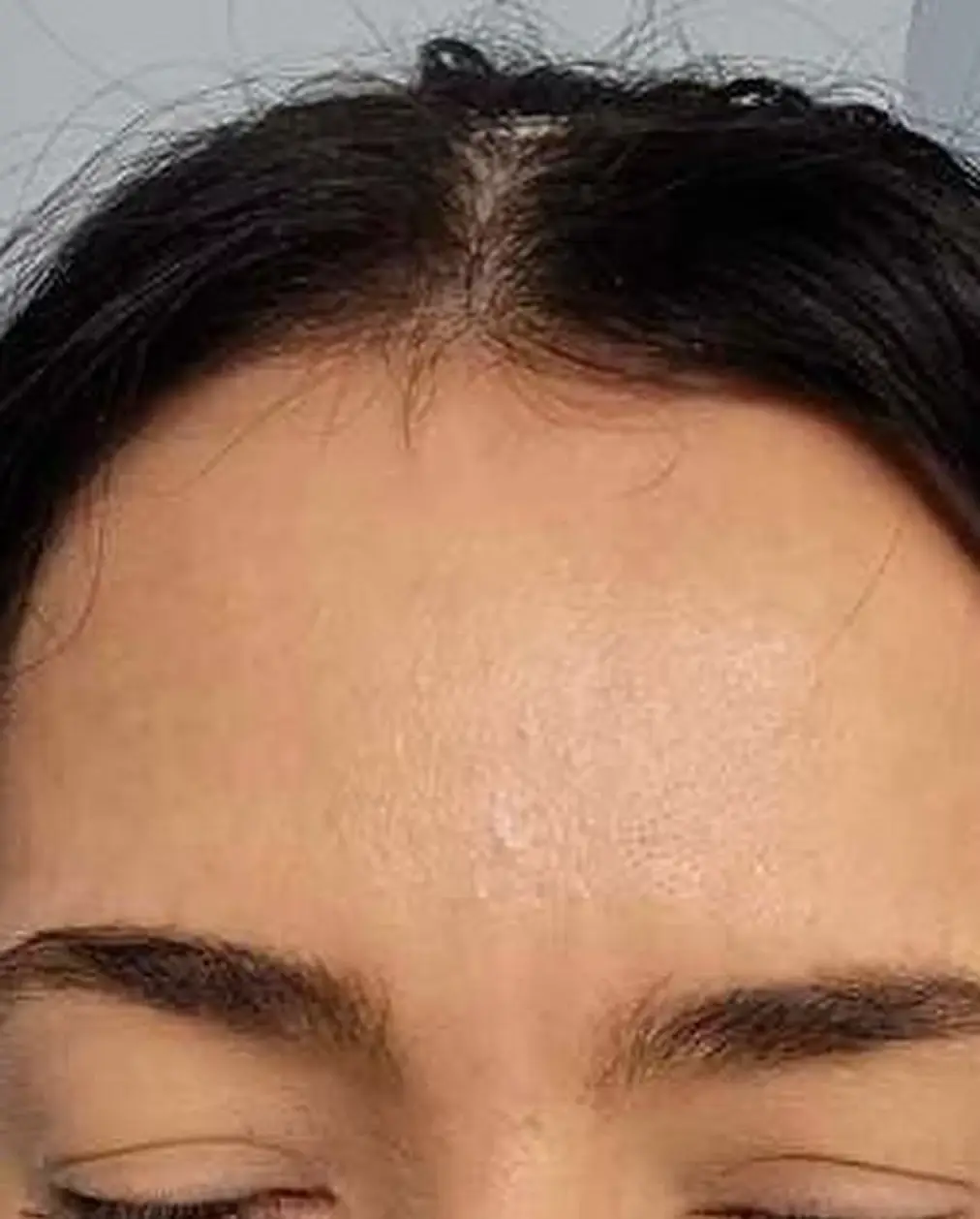 After image