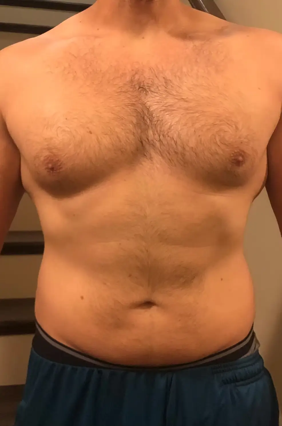 After image